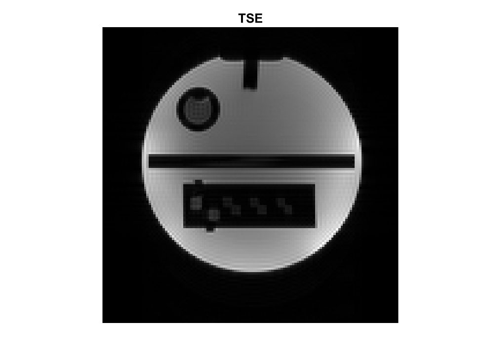 Turbo Spin Echo